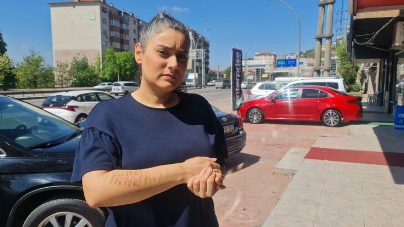 Gzellik merkezine gitti